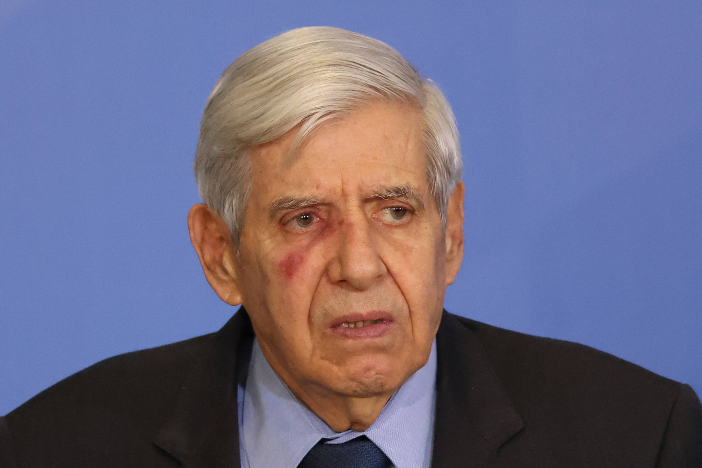 Clube Militar critica prisões relacionadas a suposta trama golpista como injustas – 26/11/2025 – Poder